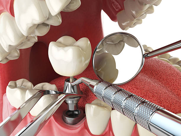 Best Emergency Treatment for Toothache in Greensburg, IN